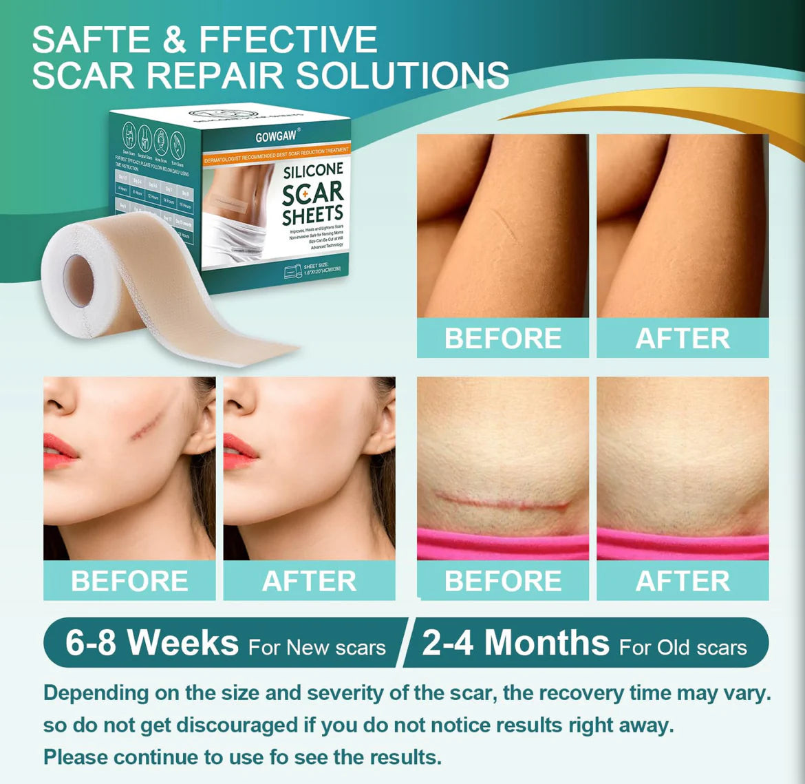 Medical Grade Silicone Scar Sheets, Silicone Scar Tape