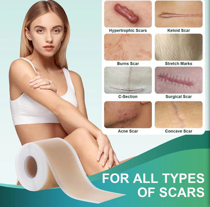 Medical Grade Silicone Scar Sheets, Silicone Scar Tape